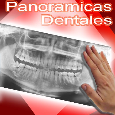 panoramica dental