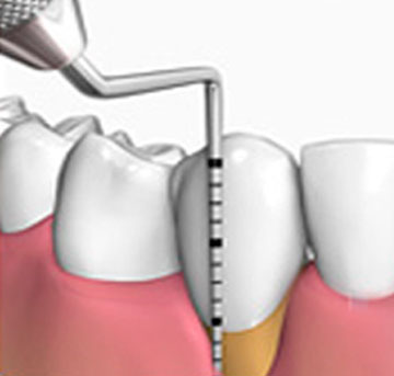 periodoncia