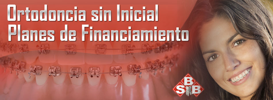 ortodoncia sin inicial, brackets convencionales y brakest trasparentes